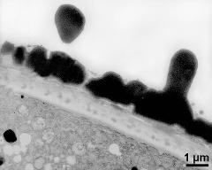 interapertural area of pollen wall