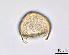 acetolyzed pollen,upper focus