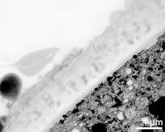 pollen wall at transition of aperture and interapertural area