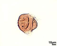 acetolyzed tetrad,equatorial view