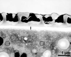 interapertural area of pollen wall