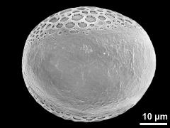 polar distal view