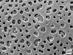 exine surface