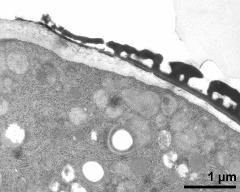 pollen wall at transition of aperture and interapertural area