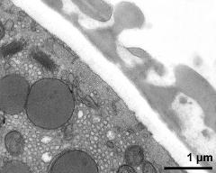 pollen wall; interapertural area