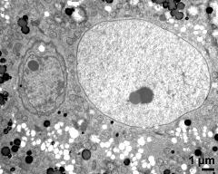 vegetative cytoplasm with generative cell (left) and vegetative nucleus (right), lipids