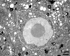 vegetative cytoplasm with generative cell