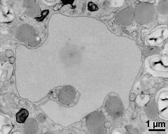 vegetative nucleus