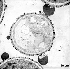 pollen grain in cross section with pollenkitt droplets (long-styled morph)