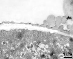 pollen wall at transition of aperture and interapertural area