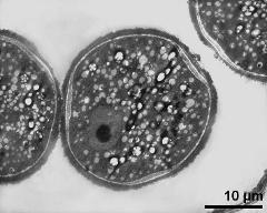 pollen grain in cross section