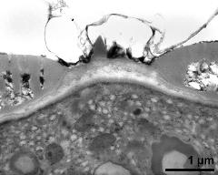 apertural area of pollen wall