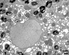 cytoplasm with vegetative nucleus, starch, lipids