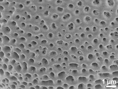 acetolyzed pollen,exine surface