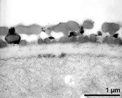 interapertural area of pollen wall