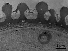 Pollen wall in the intrapertural zone,Ektexine,Endexine