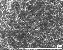 exine surface (proximal pole)