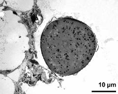 pollen grain in cross section