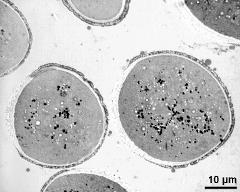 pollen grains in cross section