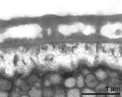 interapertural area of pollen wall