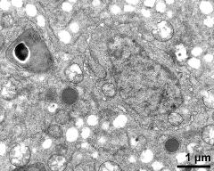 cytoplasm with generative cell  and organells