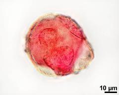 pollen grain with vegetative nucleus and generative cell