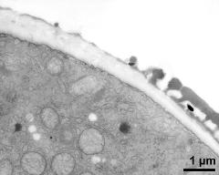 pollen wall at transition of aperture and interapertural area