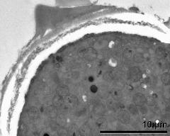 apertural area of pollen wall