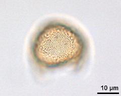 acetolyzed pollen,lower focus