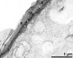 apertural area of pollen wall, intine (I), endexine (E)