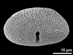 acetolyzed pollen,equatorial view