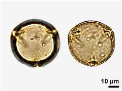 acetolyzed pollen,polar view