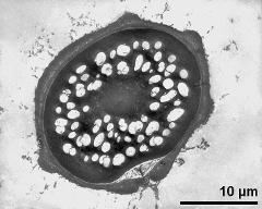 pollen grain in cross section