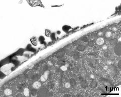 pollen wall at transition of aperture and interapertural area