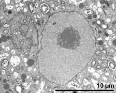 cytoplasm with vegetative nucleus (and nucleolus), generative cell (left)