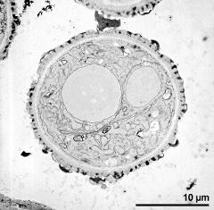 pollen grain in cross section (long-styled morph)