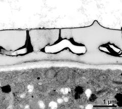 interapertural area of pollen wall