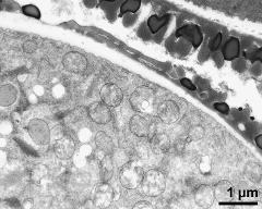 pollen wall at transition of aperture and interapertural area