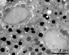 generative cell (left) and vegetative nucleus