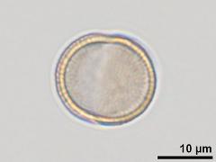 equatorial view,acetolyzed pollen