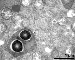 cytoplasm with organells