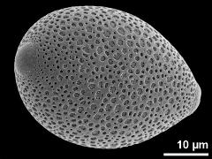 polar proximal view