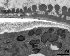 pollen wall at transition of aperture and interapertural area