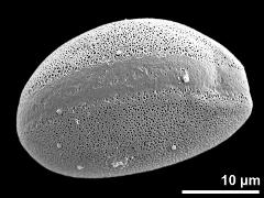 polar distal view