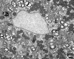 vegetative nucleus