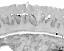 interapertural area of pollen wall, intine (I), endexine (E)