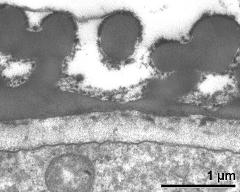 interapertural area of pollen wall