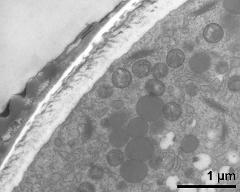 pollen wall at transition of aperture and interapertural area