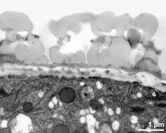 interapertural area of pollen wall