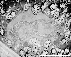 vegetative nucleus and two sperm cells